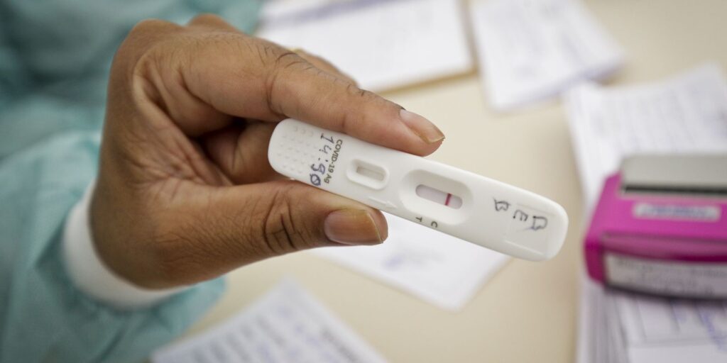 Covid-19: Brasil registra 229 óbitos e 64,36 mil casos em 24h