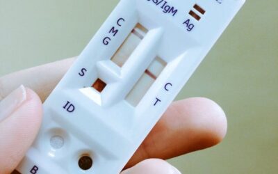MS terá teste rápido inédito para diagnóstico de dengue na rede pública