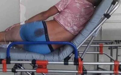 Discussão em bar termina com homem baleado no bumbum em MS