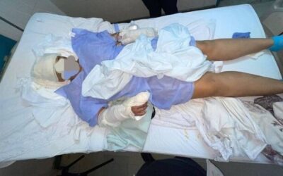 Mulher finge estar morta para sobreviver a ataque com facão na fronteira