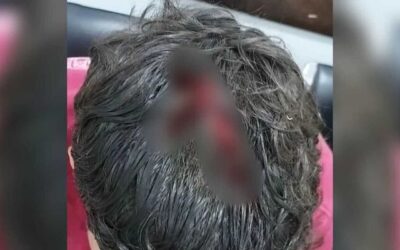 Jovem sobrevive, mas fica em estado grave após levar 5 tiros em praça de MS