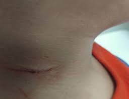 Criança de 8 anos usa caco de vidro para se cortar e parar briga dos pais no Los Angeles