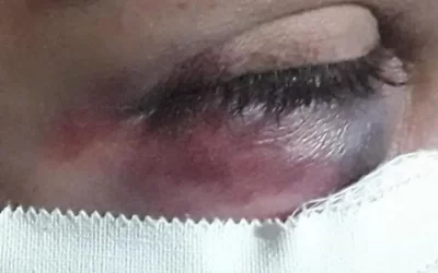 Agredida, manicure finge pedir remédio por telefone e filho aciona a polícia em Campo Grande