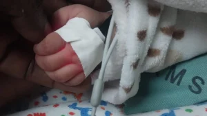 Morre bebê de 3 meses que estava internada no Hospital Regional com marcas de violência