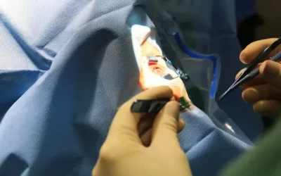 Saúde fecha acordo com Imol para facilitar captação de córneas de doadores em MS