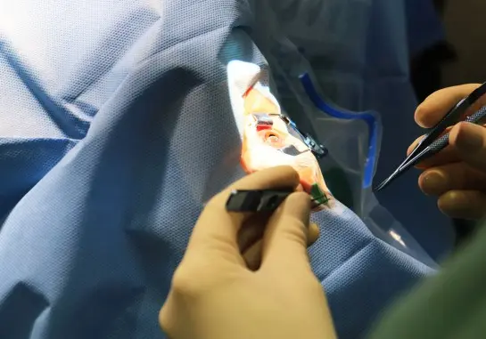 Saúde fecha acordo com Imol para facilitar captação de córneas de doadores em MS