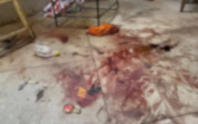 Comerciante esfaqueado por ladrão teve loja invadida 3 vezes: ‘Escapei da morte’